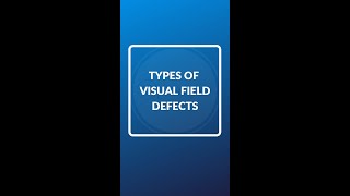 Types of visual field defects shorts optometry optomyze [upl. by Pergrim]