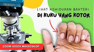 Zoom 1000x  Lihatlah Ngerinya Bakteri di KUKU yang KOTOR Bikin merinding [upl. by Doreg783]