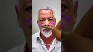 Dr Murilo Cecilio com muita excelência e naturalidade harmonização facial [upl. by Lleinad225]