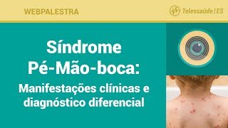 Webpalestra Síndrome PéMãoBoca  Manifestações clínicas e diagnóstico diferencial [upl. by Ecilef]