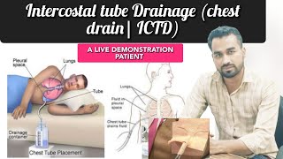 ICTD Chest tube insertion Pneumothorax treatment Thoracostomy procedure [upl. by Bernardi755]