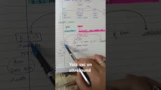 OBSTETRIC ULTRASOUND BASICS PART 1 MRCOG1 mrcog discussyourstudyoptionwithus [upl. by Ianej885]