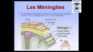 Méningite bactérienne cérébro spinale maladie infectieuse [upl. by Seton]