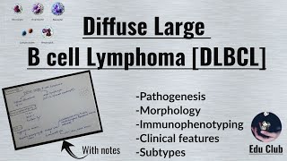 Diffuse Large B cell Lymphoma  DLBCL  Non Hodgkins Lymphoma  Pathology [upl. by Borer]