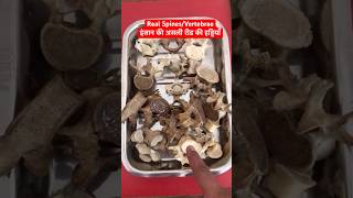 Human Real Spines  Vertebrae  रीड़ की हड्डियाँ short trending viralshorts [upl. by Dagall]