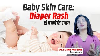 Baby Skin Care Diaper Rash से बचने के उपाय  Dr Sonal Parihar [upl. by Acul]