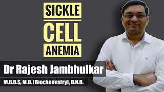 Sickle cell anemia [upl. by Ibbed]