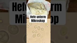 So sieht Hefe unterm Mikroskop aus wissenswert biologie natur mikrokosmos mikroskop fyp [upl. by Diandre]