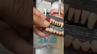 COMO LOGRAR UNA DENTADURA COMPLETA INFERIOR CON NURIADENTAL PASO 4 nuriadental protesisdental [upl. by Eel]