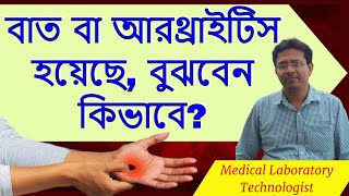 Signs and Symptoms of Arthritis  আরথ্রাইটিস রোগের লক্ষণ ও উপসর্গ [upl. by Rofotsirk]