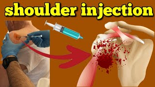 How to give injections at home घर पर इंजेक्शन कैसे लगाएंinjection kaise lagate hai [upl. by Kohsa223]