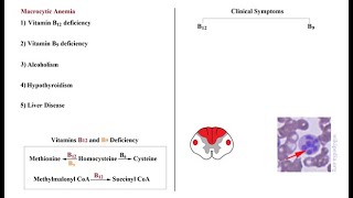 USMLE ACE Video 170 Macrocytic Anemia [upl. by Nekcerb]