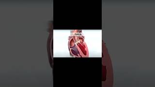 Aortic Valve Surgery Explained in 60 Seconds [upl. by Ruvolo349]