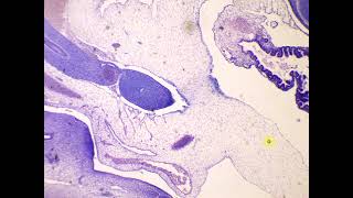 Mesenchymal mucoid embryonal c t 10mm Pig Embryo [upl. by Diarmit]