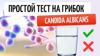 Candida albicans Простой домашний тест на грибок и что делать если тест положительный [upl. by Eanil]