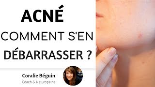 SE DÉBARRASSER DE L’ACNÉ DÉFINITIVEMENT BOUTONS MICRO KYSTES  Coralie Beguin Naturopathe [upl. by Xavler]