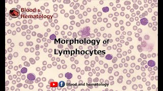 Morphology of Lymphocytes [upl. by Kcire]