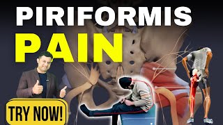 Top 3 Exercises for Piriformis Syndrome Pain Relief MUST TRY [upl. by Drawdesemaj]