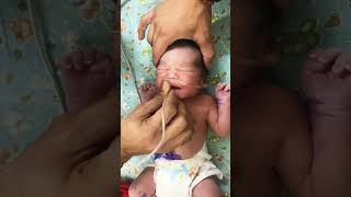 Neonatal resuscitation 🥰 Suction of newborn baby baby paediatric neet babyboy newborn [upl. by Epp86]