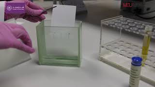 Biochemistry Lab  Thin layer chromatography for separation and identification of lipids [upl. by Issor]