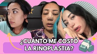 TODO lo que debes saber sobre la RINOPLASTIA🤥Cuánto cuesta una Cirugía de nariz🤑 [upl. by Annissa]