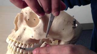 Skull Anatomy 2 of 5 Anterior View and Mandible  Head and Neck Anatomy 101 [upl. by Sverre]