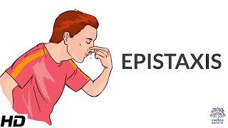 Epistaxis Causes SIgns and Symptoms Diagnosis and Treatment [upl. by Virgilio612]