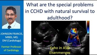 What are the special problems in CCHD with natural survival to adulthood [upl. by Akcimahs735]