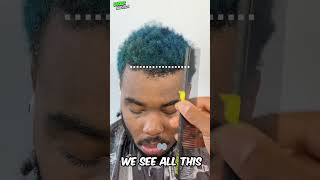 Craziest Hairline Fix Ever chocolatemoose7294 [upl. by Haeel]