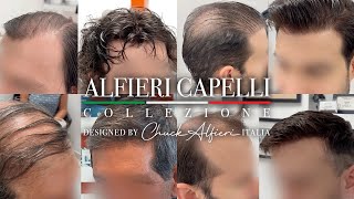 Chuck Alfieri Capelli Hair Replacement for Men Compilation 24 [upl. by Aurel]