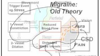 Migraine 1 The Experience [upl. by Mast]