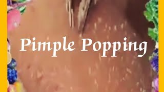 Pimple amp Blackheads Popping  50 [upl. by Ocir578]