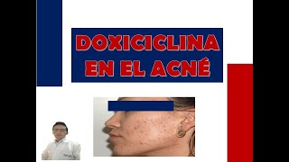 DOXICICLINA PARA QUÉ SIRVE DOXICICLINA  USOS EN EL ACNÉ DE DOXICICLINA [upl. by Care790]