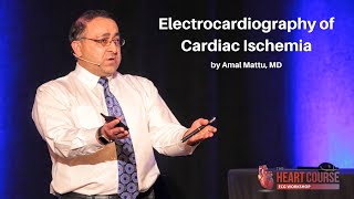 Electrocardiography of Cardiac Ischemia  The Heart Course ECG Workshop [upl. by Roseanna999]