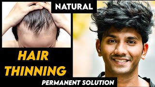 THIN HAIRS TO THICK HAIR At Home NaturallyStronger amp Thicker Hair बालों को घना मोटा कैसे करेHindi [upl. by Siuqram893]