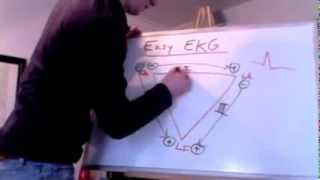 Easy EKG Einthovens Triangle [upl. by Anissa570]