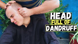 Dandruff Head Heavy Oily Head Massage ASMR To Relief Headache Neck amp Head Massage [upl. by Xad]