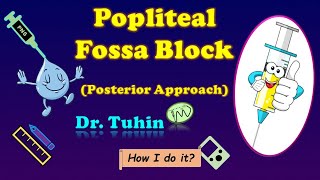 PNS guided Popliteal Sciatic Nerve Block  Intertendinous Approach  Popliteal Fossa Block [upl. by Ennahtebazile]