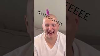 GOATed 🐐 BALD TRICK SHOTS comedy funny lol alopecia mcsquared90 [upl. by Notserc850]