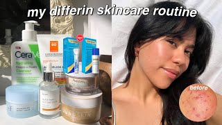 MY Differin Gel Skincare Routine [upl. by Wolf]