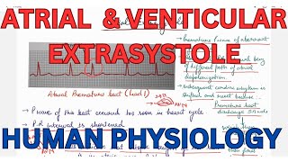 ATRIAL extrasystole Ventricular Extrasystole compensatory pause CVS [upl. by Anestassia]