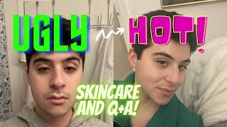 ugly to hot skincare transformation qa [upl. by Cornew195]