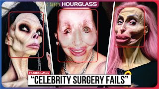 15 Celebrity Plastic Surgery Disasters [upl. by Egide]