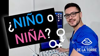 ¿Cómo saber si es NIÑO o NIÑA por ULTRASONIDO [upl. by Hsuk]