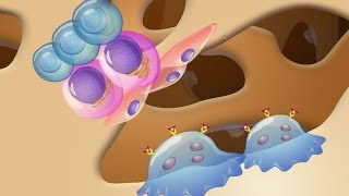 Pathogenesis and Treatment of Myeloma Bone Disease [upl. by Klayman]