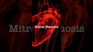 Normal vs Mitral Stenosis [upl. by Malynda]