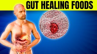 6 Best Prebiotic Foods for Ultimate Gut Health Balance [upl. by Flam]