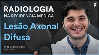 Lesão Axonal Difusa  Radiologia na Residência Médica [upl. by Reiss]