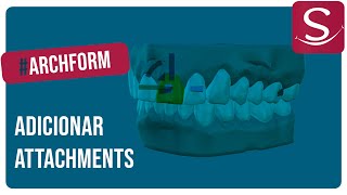 Archform adicionar attachments [upl. by Maidel]