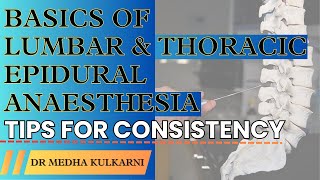 Mastering Epidural Anesthesia Essential Tips for Consistency I Dr Medha Kulkarni [upl. by Naggem]